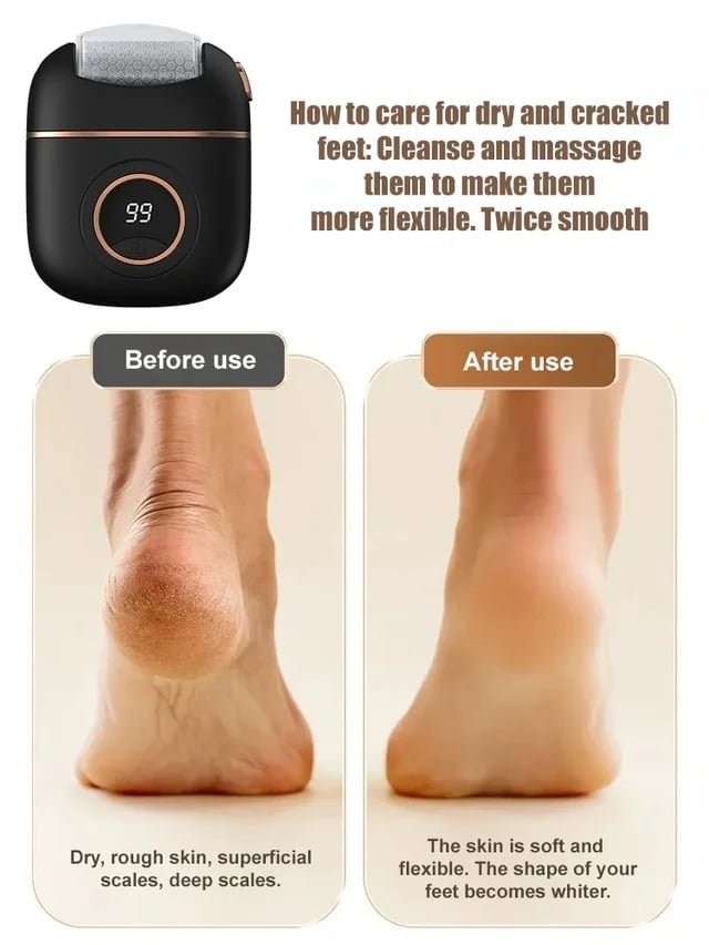 Digital Electric Foot Polisher - 2